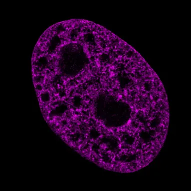 Some round gaps (black) start appearing in a cell purple, an hour after being infected with the herpesvirus. This is the second of four images in a slideshow.