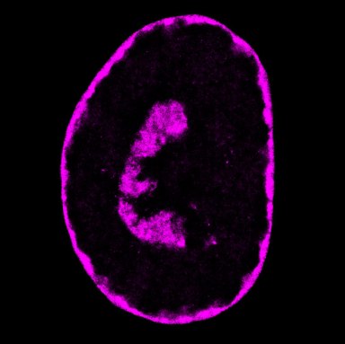 Eight hours after an infection by the herpesvirus, the cell's DNA is mostly compacted into a crescent shape in the middle of the cell (shown in purple). This is the fourth image of four in a slideshow.