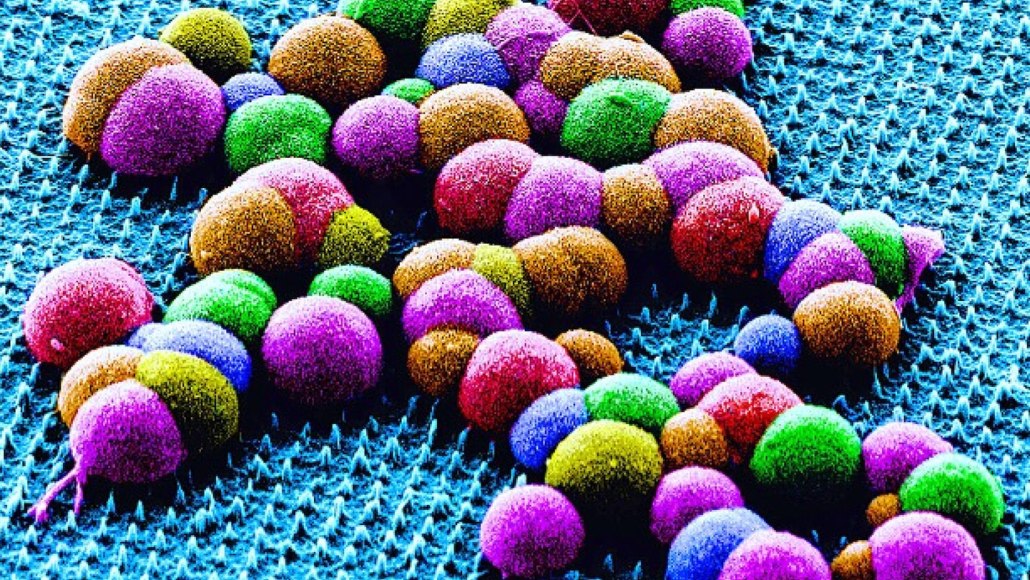 What looks like different colored balls (smooth muscle cells seen in false color) sit atop a turquoise patch studded with tiny nanoneedles.