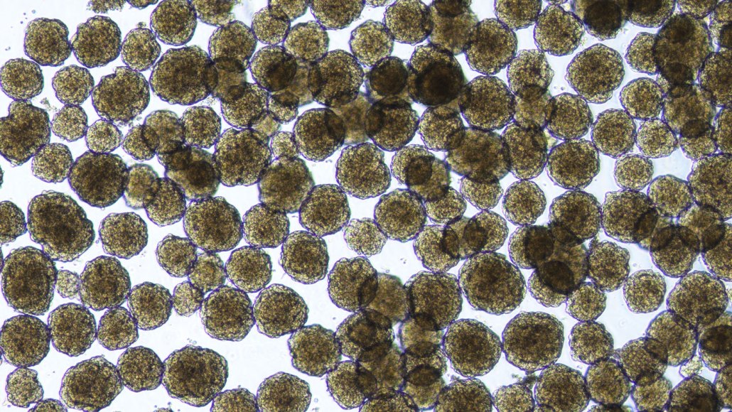 Clusters of brownish yellow cells used for diabetes treatment, viewed under a microscope.