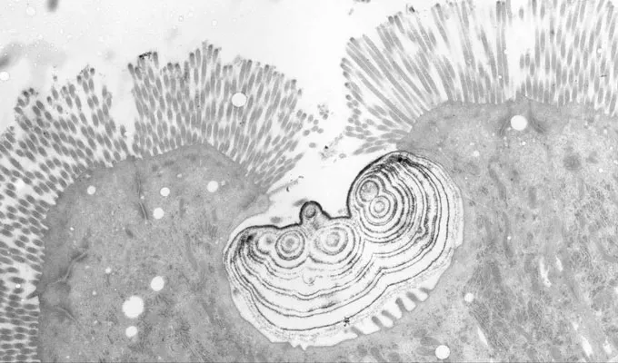 An electron microscopy image of the multilayered particle of calcium and phosphorus that the bones of python's prey becomes