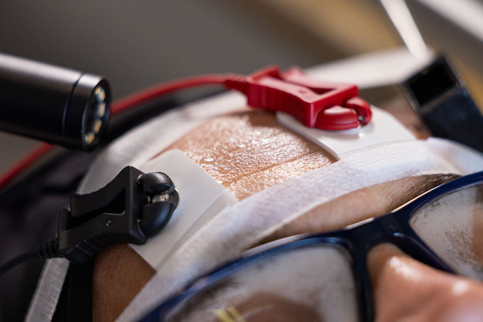 A closeup of a person's forehead shows sweat beginning to pool. Instruments to measure that are attached to the person.