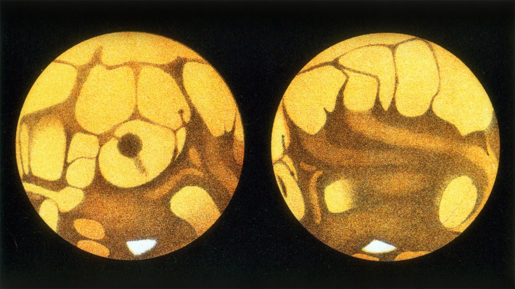Two yellow orbs beside each other with smaller white blobs inside.