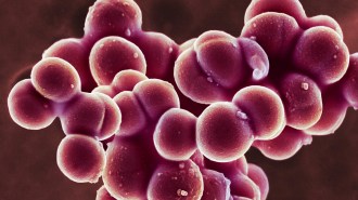 Image shows round, purple bacteria clustered together. The cluster appears like a clump of grapes.