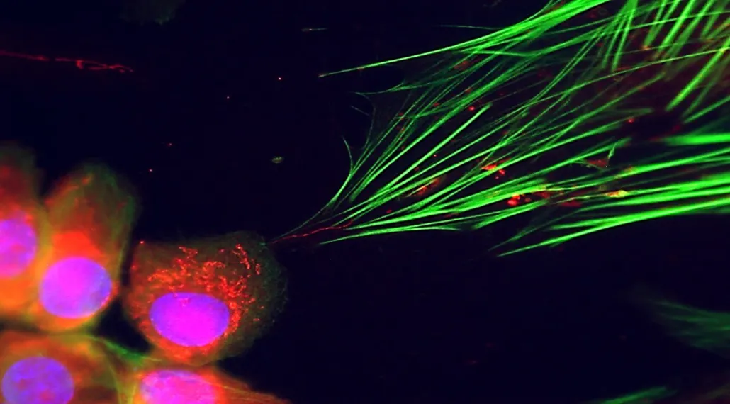 Cancer cells connect to neighboring cells via a skinny green tube.