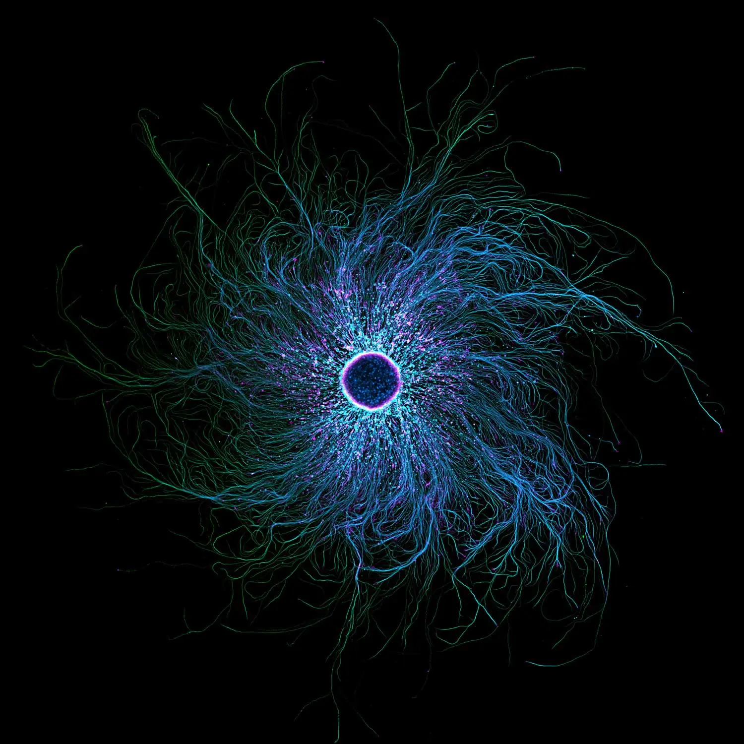 Thin wispy root-like microtubules spiral around a dark center. Pink dots speckle the perimeter of the dark center.