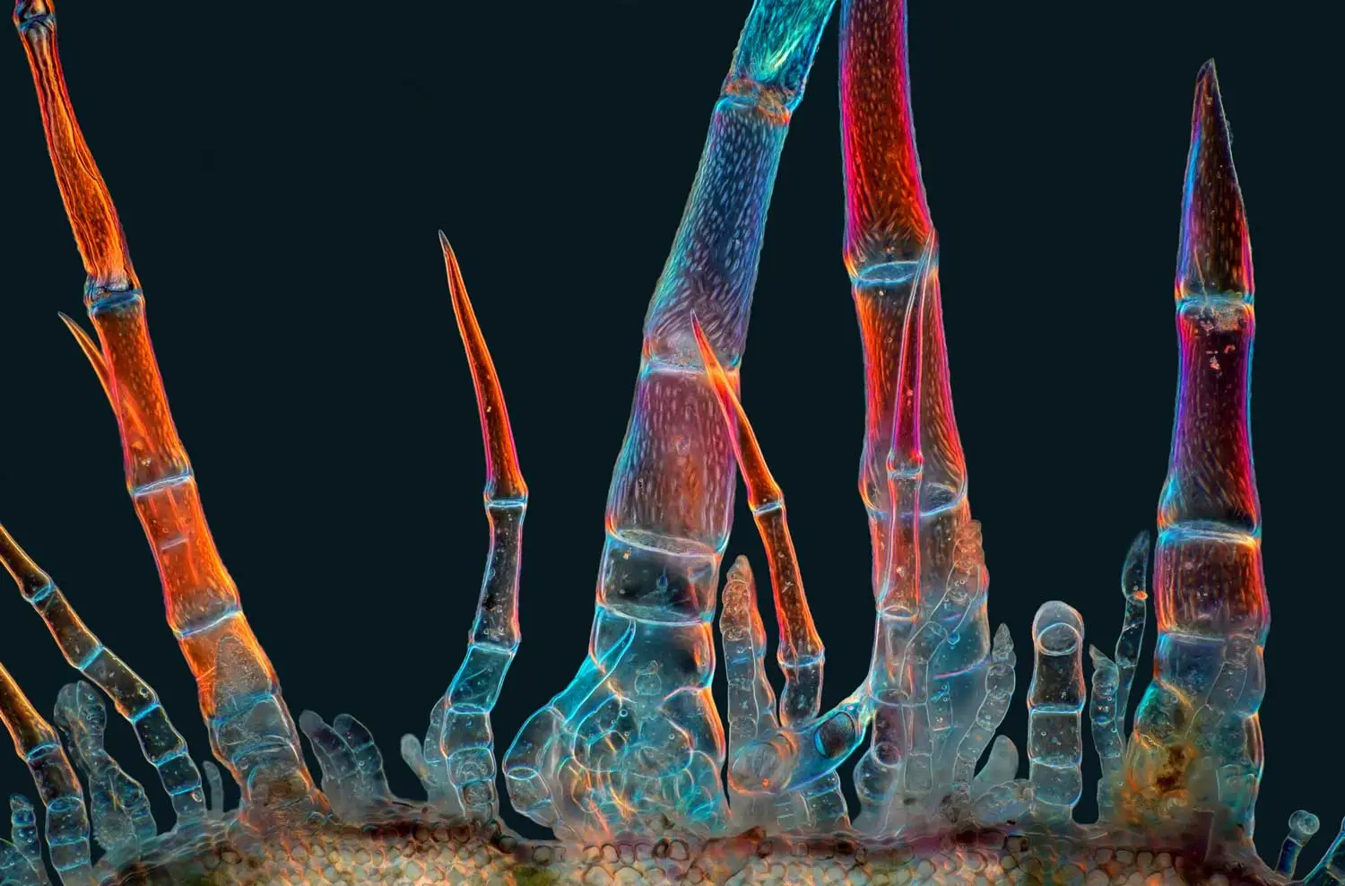 Fluorescent trichrome that look like human finger bone x-rays stretch upward in various heights and widths.