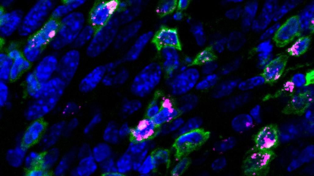A microscopy picture showing cells stained blue, green and pink.