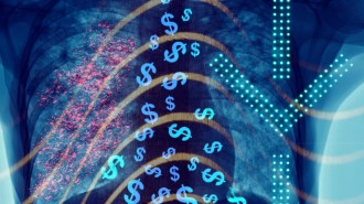Illustration of an X-Ray of a tuberculosis patient's lungs, flooded with dollar signs