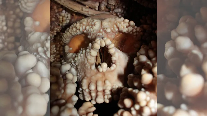 A close-up image of a fossilized human skull covered in smooth white bumps of calcification