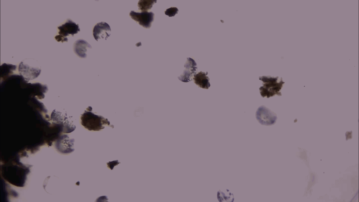 Giant speckled bacteria viewed under a microscope lens.