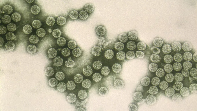 sciencenews.org - Tina Hesman Saey - He made beer that's also a vaccine. Now controversy is brewing