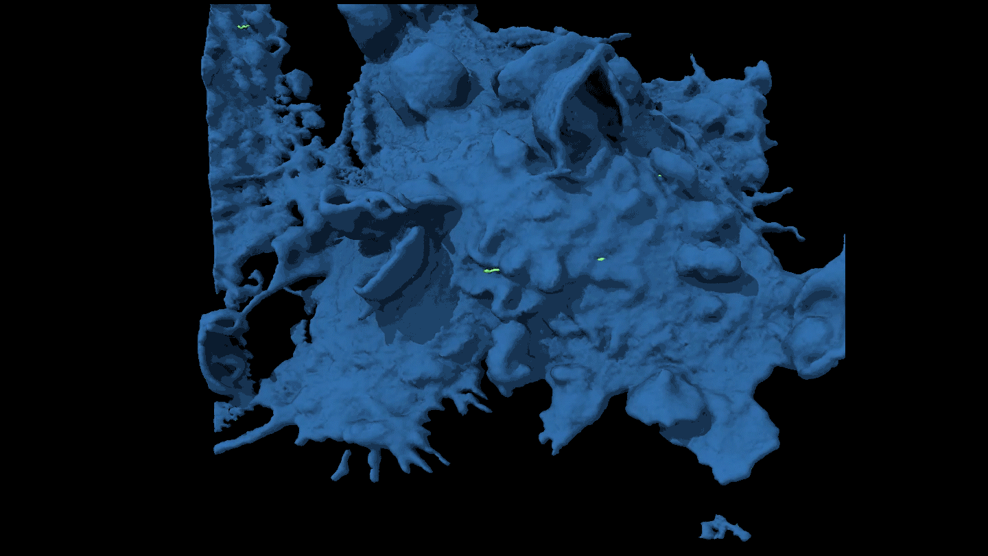 In this microscopy video, a cancer cell appears to wriggle away from an immune cell.
