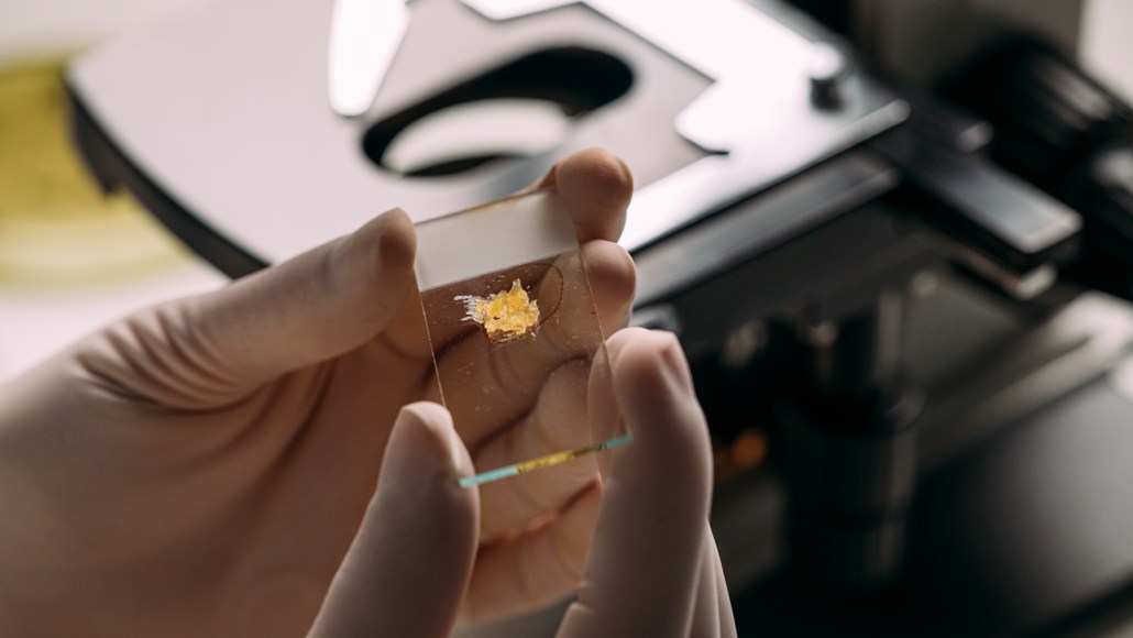 Gloved hands hold a microscope slide with a tissue sample on it