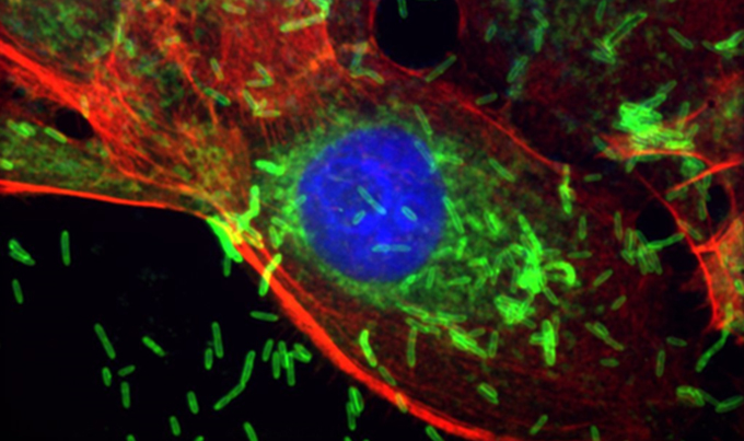 Microscopy image showing a breast cancer cell with rod-shaped bacteria invading.
