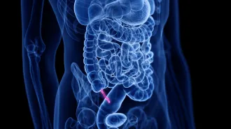 An illustration shows the ghostly outline of a human body with the internal organs and bones visible. The appendix shows up as a bright pink squiggle attached to the intestines.