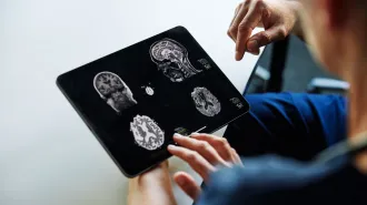 Doctors review medical scans. AI could help improve diagnoses.