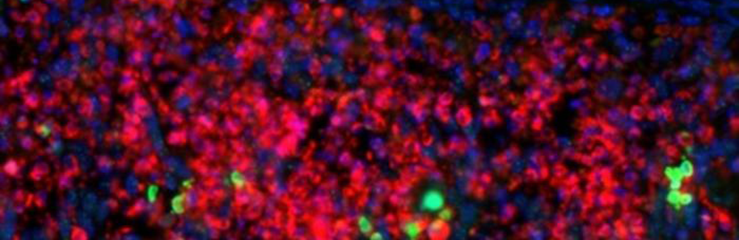 This slice of mouse brain looks like an abstract painting made with dots. The red ones are dead brain cells and the green ones mark DNA damage.