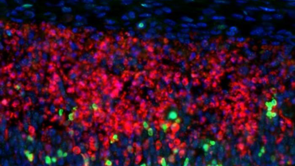 This slice of mouse brain looks like an abstract painting made with dots. The red ones are dead brain cells and the green ones mark DNA damage.