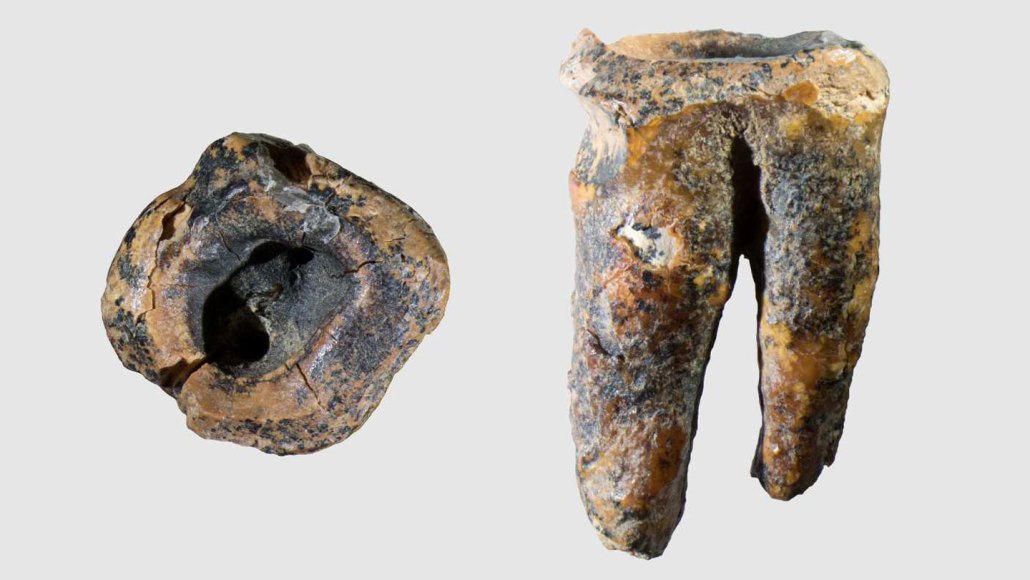 Two views of a brown-and-yellow ancient molar are shown side by side. The first shows a drilled hole from the top, and the second shows the side profile of the tooth.