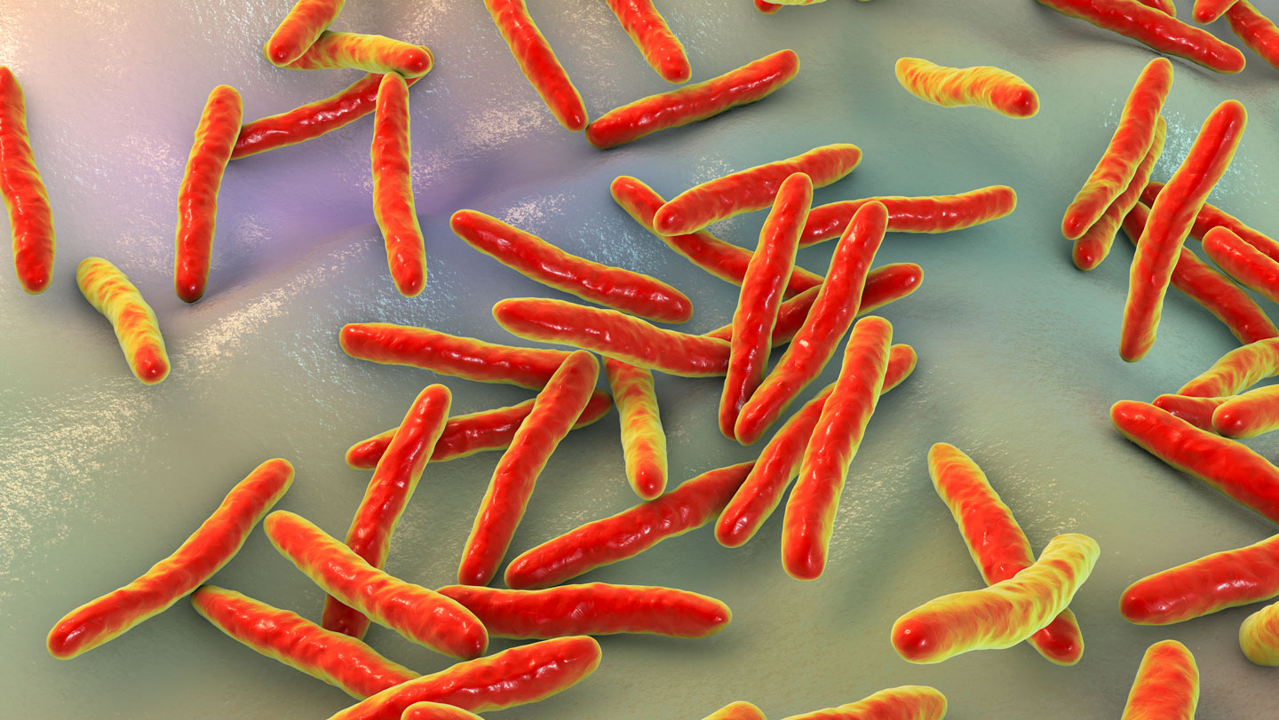 A $4 tongue swab test detects tuberculosis within 30 minutes