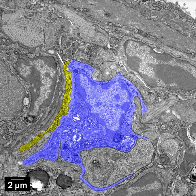 This close-up of pigeon liver immune cells shows an area in blue, denoting the cells are filled with iron. A narrow line of yellow, denoting nerves, curves along one side of the blue blotch. The rest of the image is varying tones of gray.