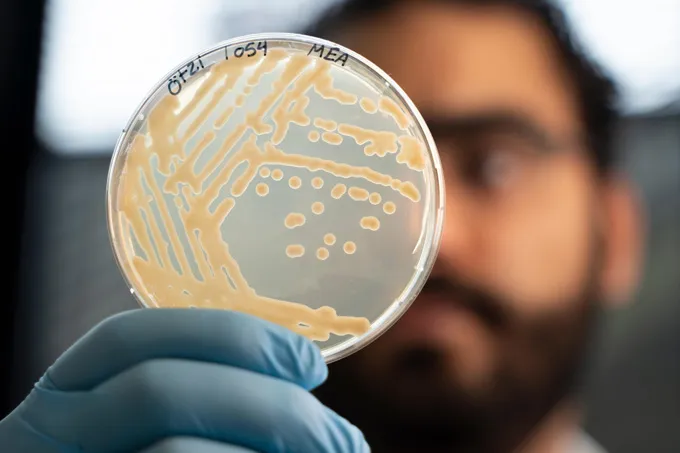 A petri dish of yeast grown from Otzi the Iceman