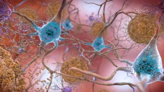 An illustration shows blue hubs filled with threadlike squiggles to denote tau in the brain. Fuzzy brown orbs represent amyloid plaques. Both are hallmarks of Alzheimer's disease.