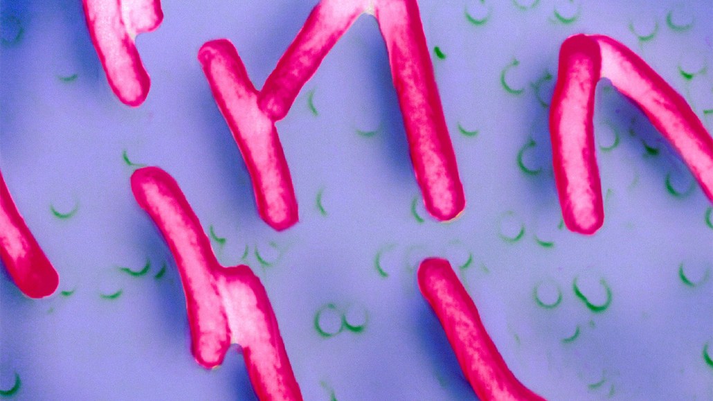 Illustration of Shigella sonnei bacteria that cause infections