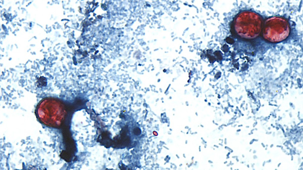 A microscope image of cyclospora.