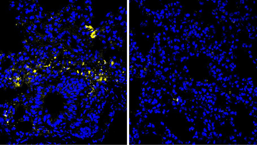 Microscopy images of lung tissue showing blue cell nuclei and yellow coronavirus.