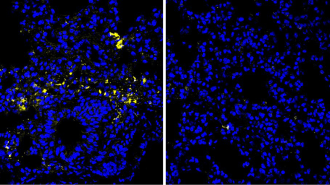 Microscopy images of lung tissue showing blue cell nuclei and yellow coronavirus.